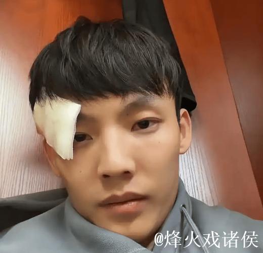 广东遭遇伤病危机！徐杰眉骨开裂杜润旺肩部撕裂，两新援尚未登场